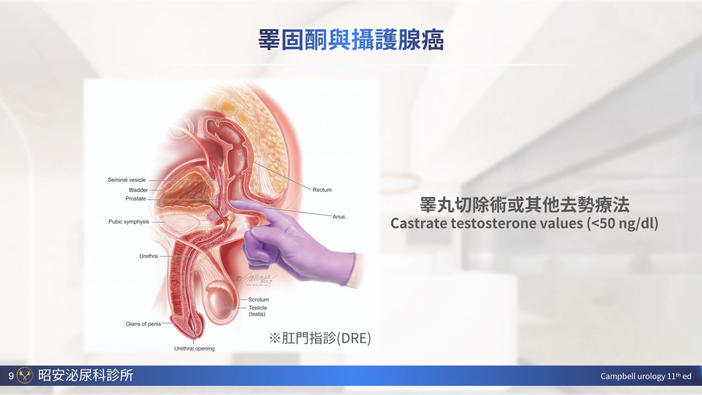 男性更年期與睪固酮補充 Testosterone replacement therapy 陳昭安醫師